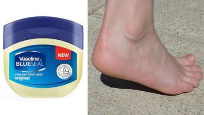 Cracked Heels With Vaseline